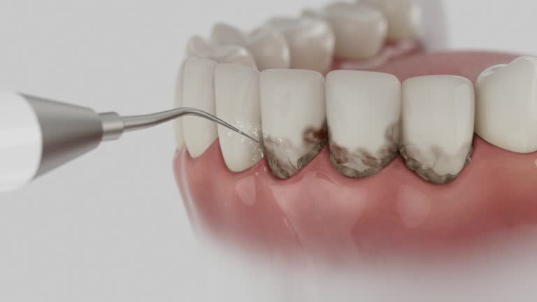 Trusted Wisdom Tooth Removal service in North Tustin, CA - Dentist Open Now